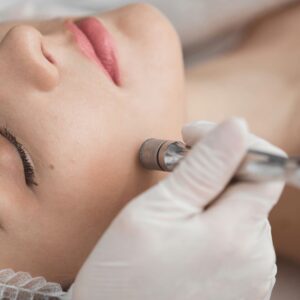 Microneedling