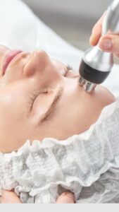 Radiofrecuencia facial: qué edades realmente necesitan este tratamiento