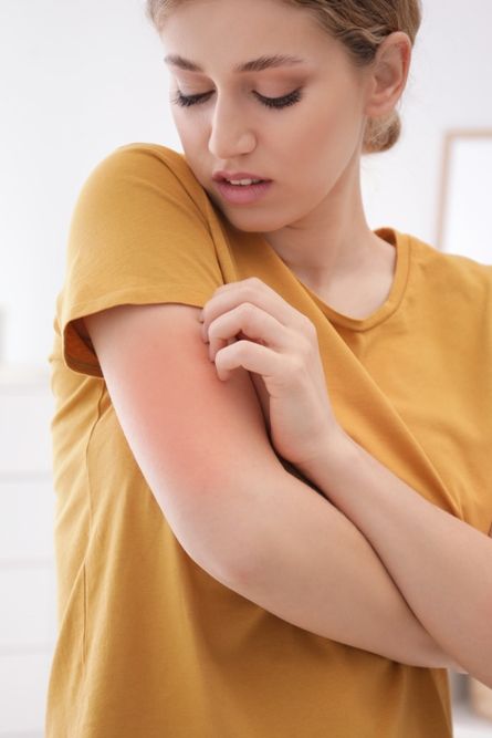 Queratosis Pilaris: Exfoliación Química vs Física