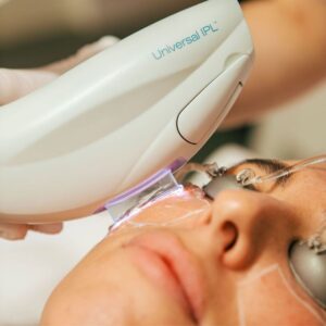 Láser fraccional: cuándo vale la pena la inversión