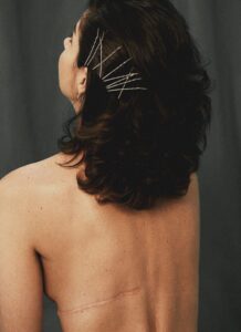 Cicatrización Óptima: Vitaminas + Suplementos Científicos