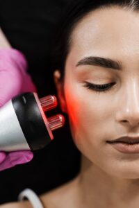 Radiofrecuencia facial: qué edades realmente necesitan este tratamiento