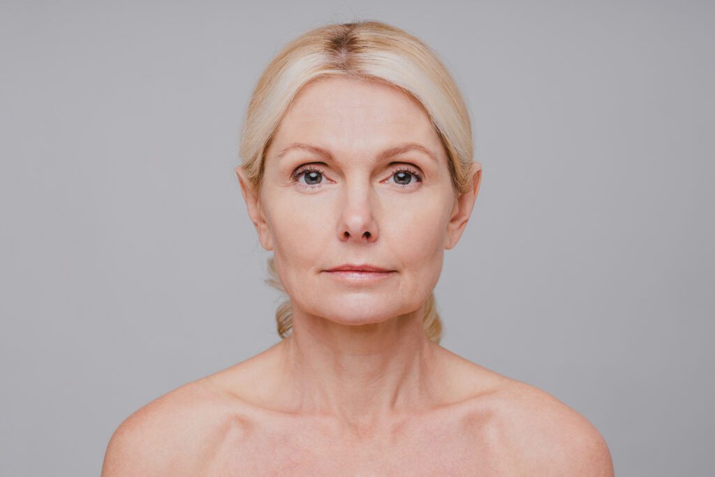 Deep Plane Facelift: Resultados Naturales Sin Cirugía Mayor