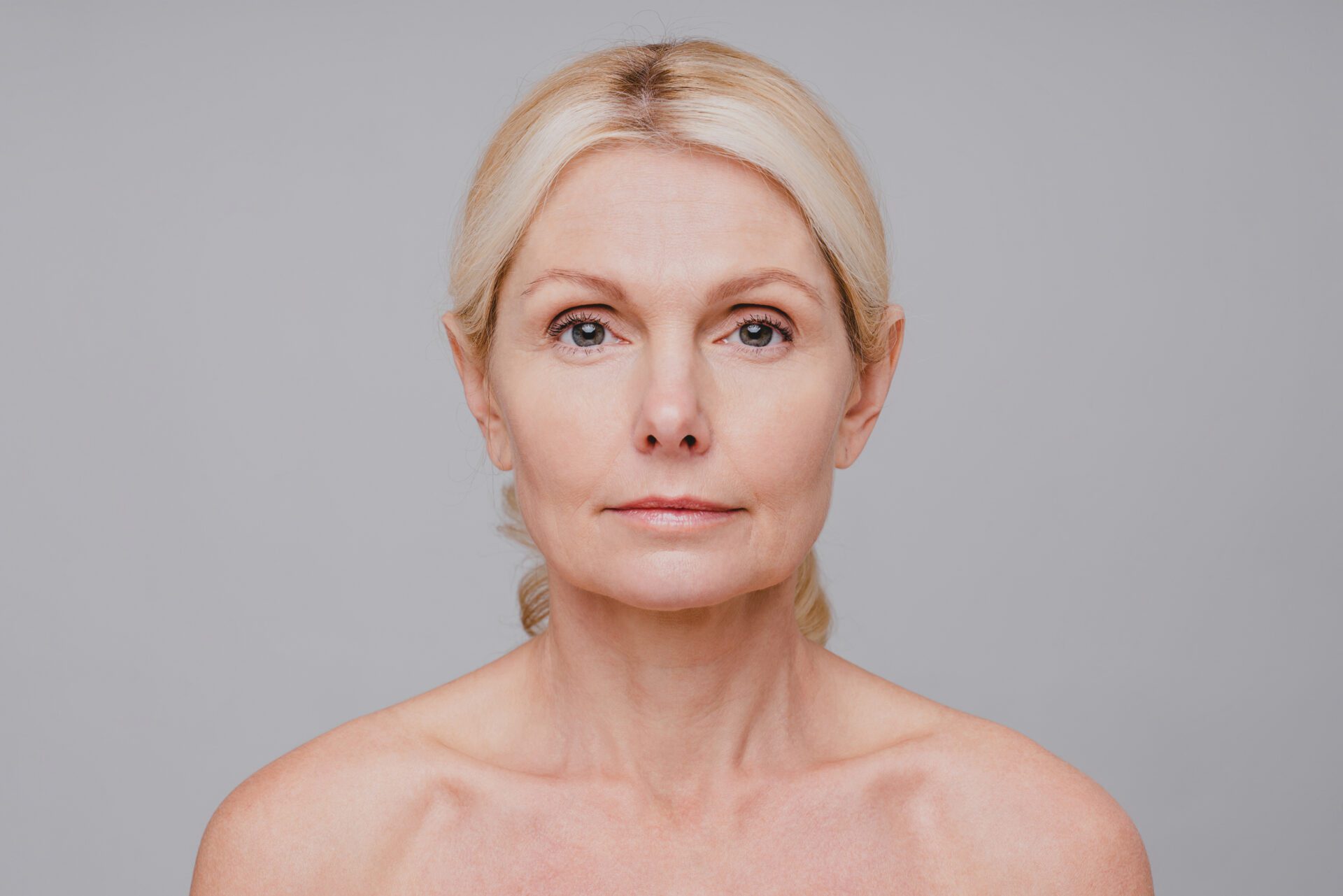 Deep Plane Facelift: Resultados Naturales Sin Cirugía Mayor