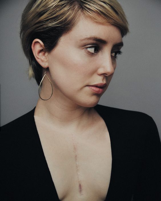 Cicatrización Óptima: Vitaminas + Suplementos Científicos