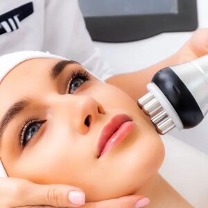 Radiofrecuencia Facial: Resultados Reales
