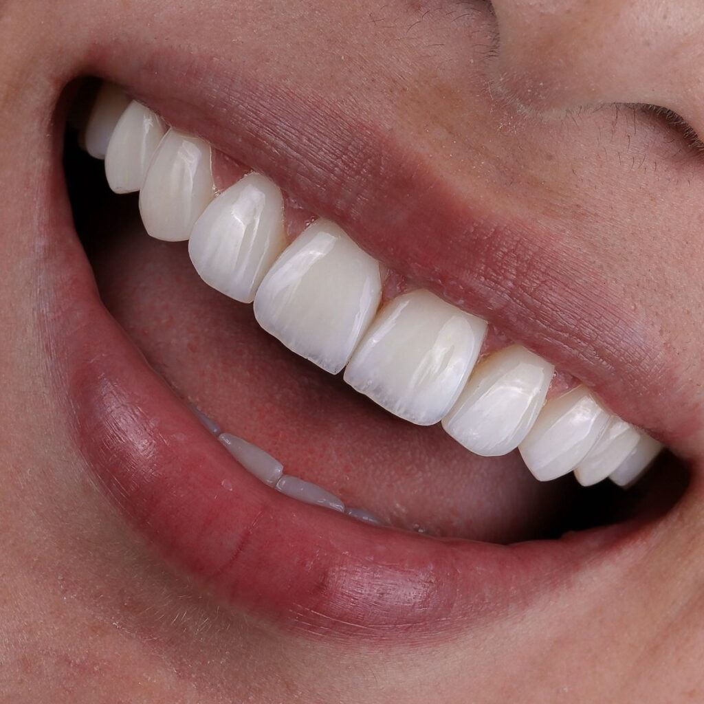 Arquitectura de la sonrisa: la nueva era donde la belleza se siente, no solo se ve